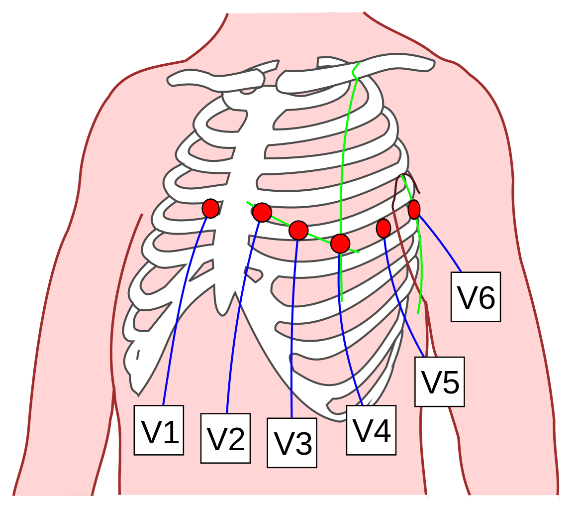 ECG Chest Lead Positions for 12 Lead ECG SimpleMed