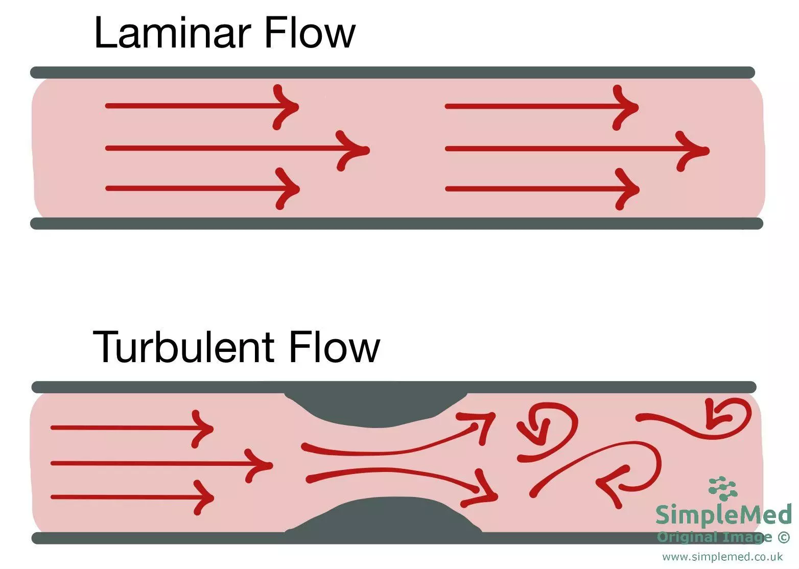 Blood flow in blood vessels - Laminar and Turbulent flow SimpleMed