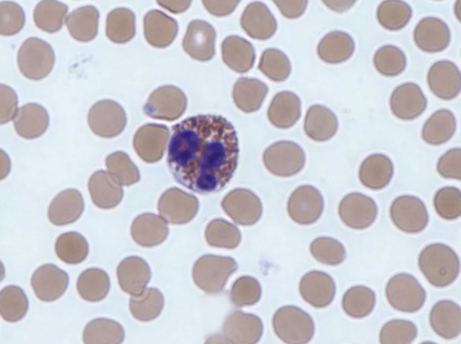 Eosinophil Histology SimpleMed