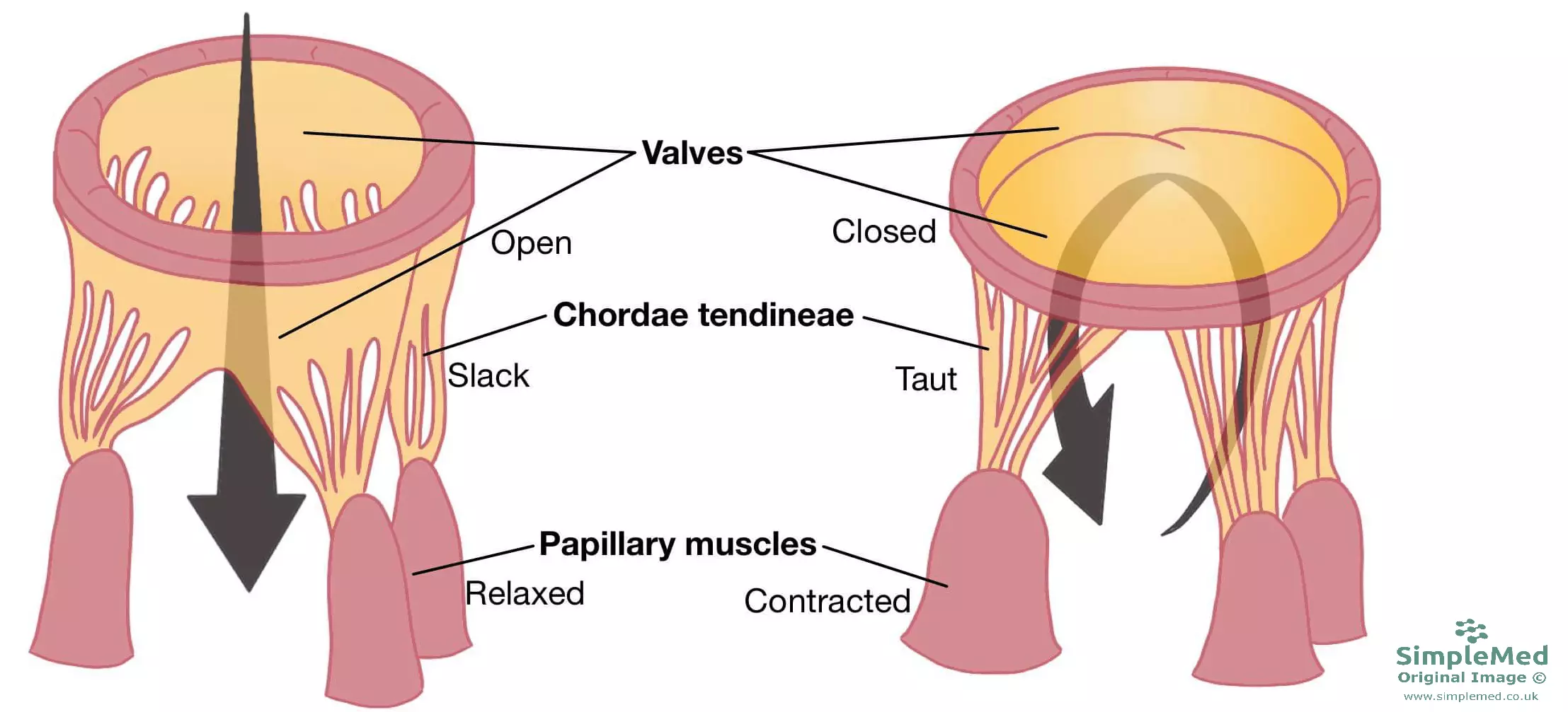 Valves of the Heart and chordae tendineae SimpleMed 