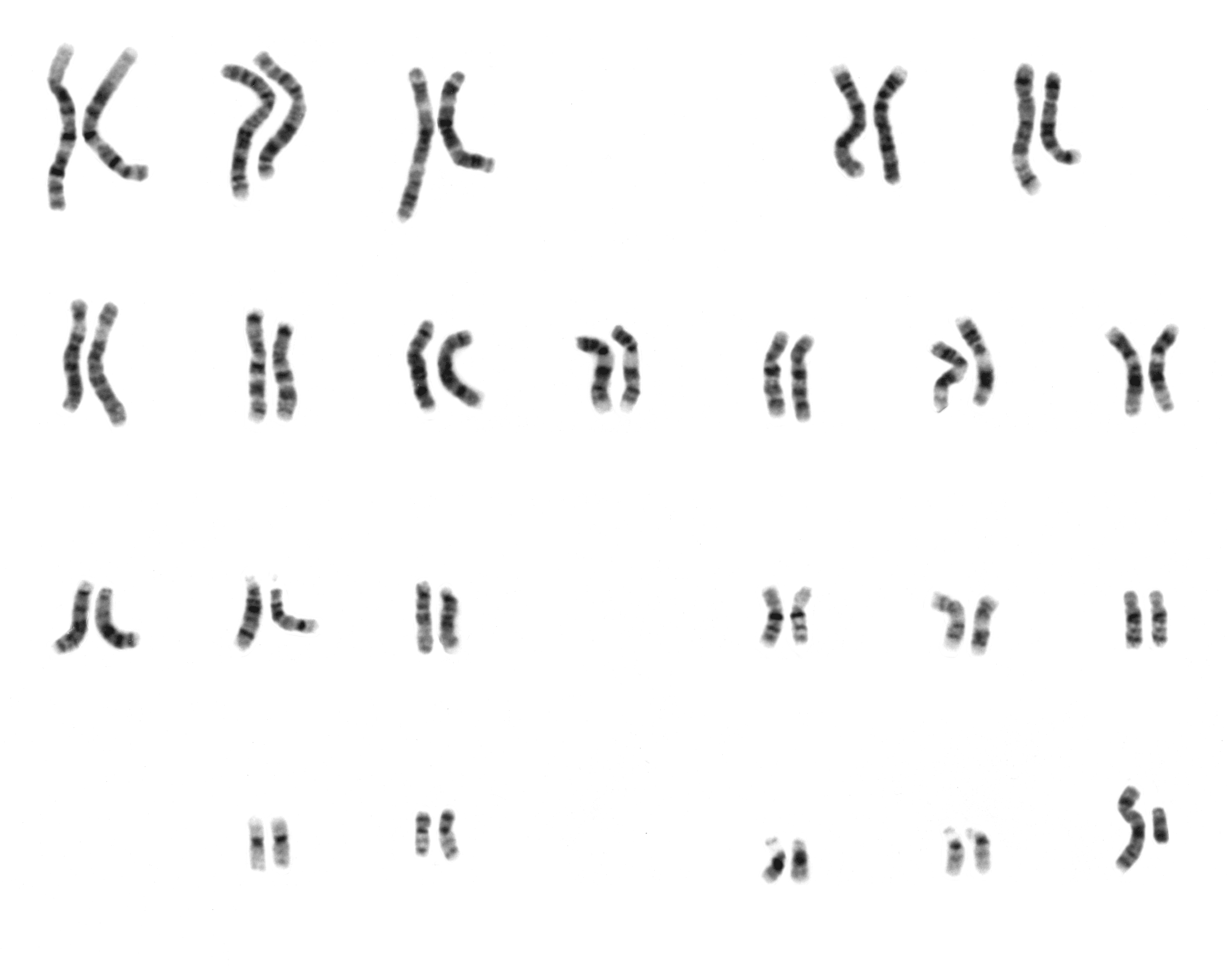 Normal Male Karyotype SimpleMed