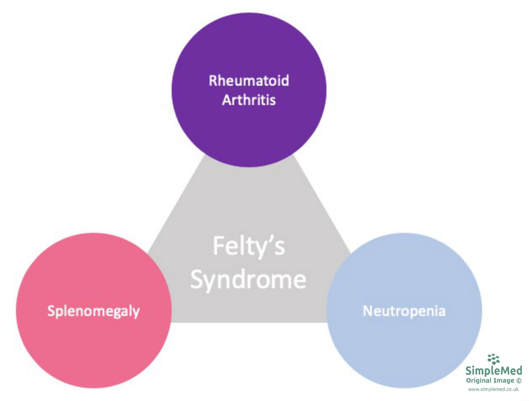 Felty's Syndrome Triad SimpleMed