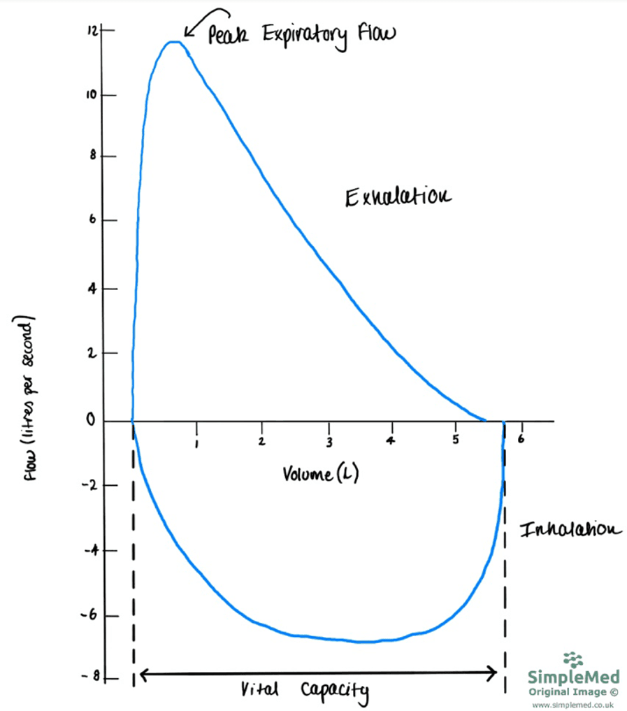 Normal Flow Volume Curve SimpleMed