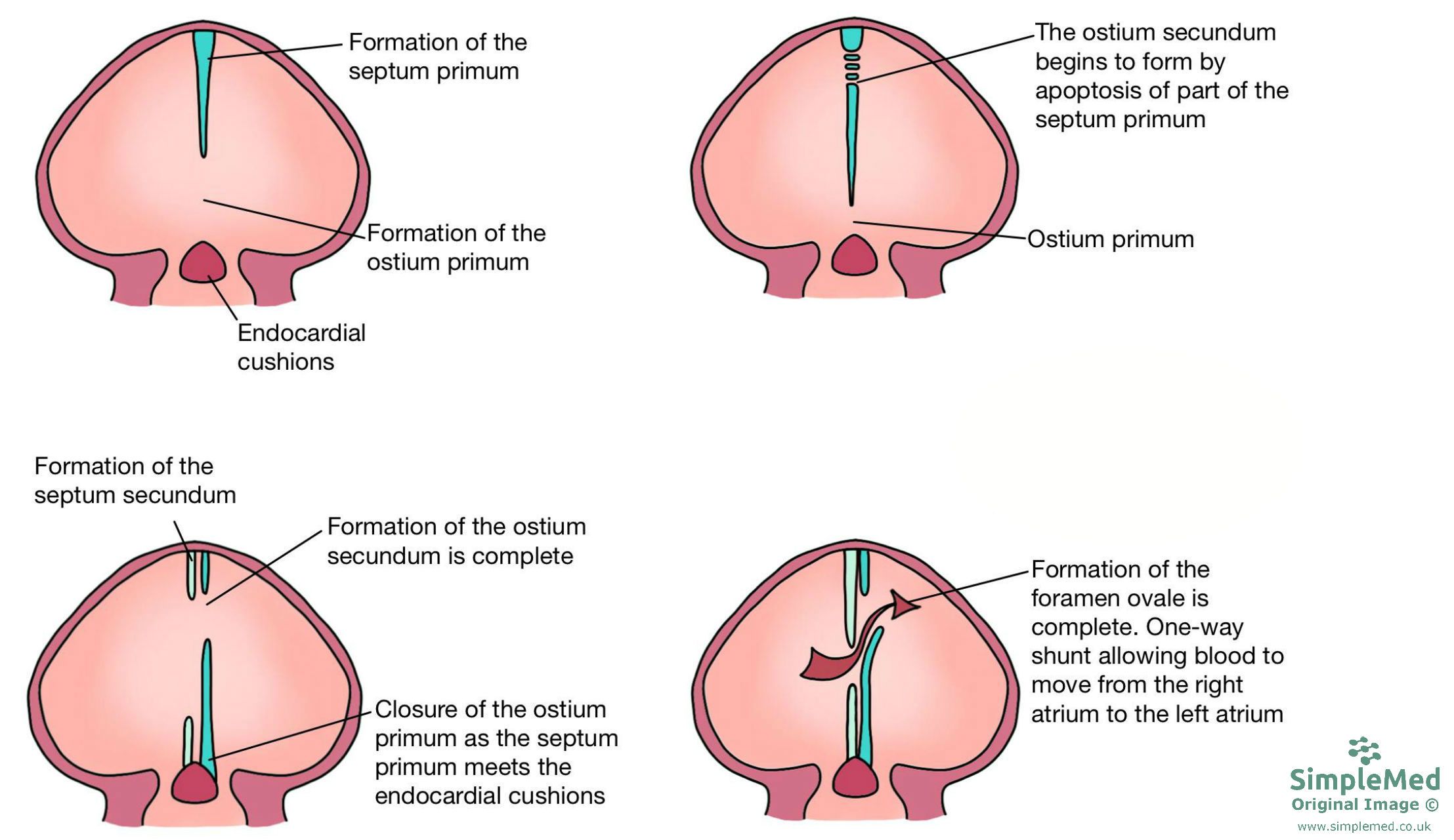 Formation of the Atrial Septum SimpleMed