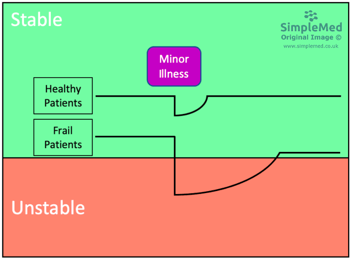 Frailty and the Effect of Minor Illness SimpleMed