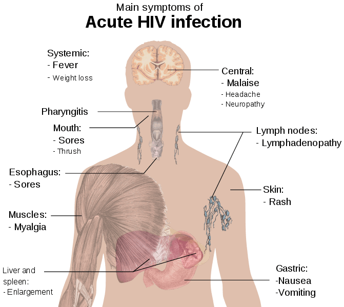 HIV Symptoms SimpleMed