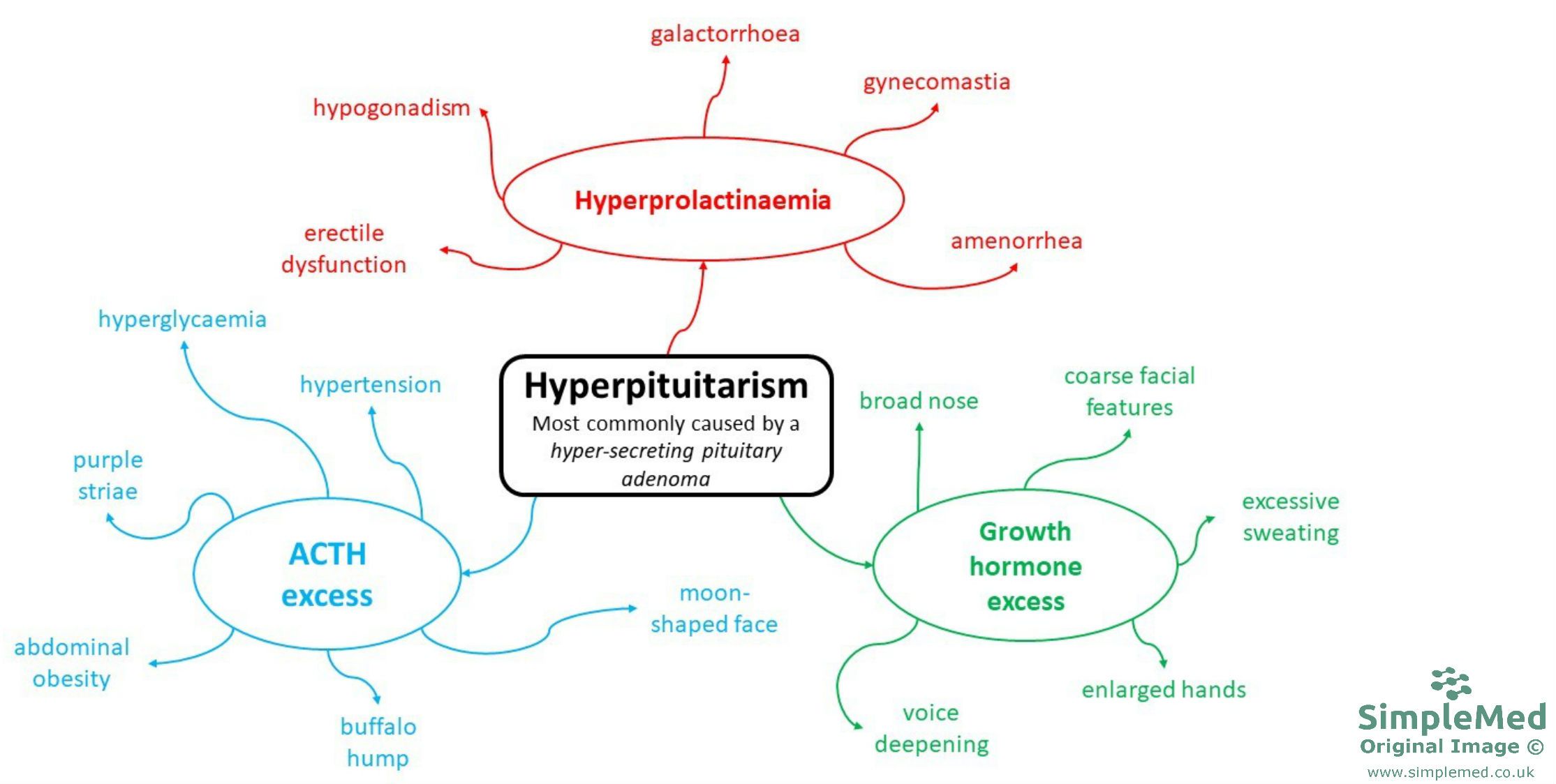 Hyperpituitarism Mind-Map SimpleMed