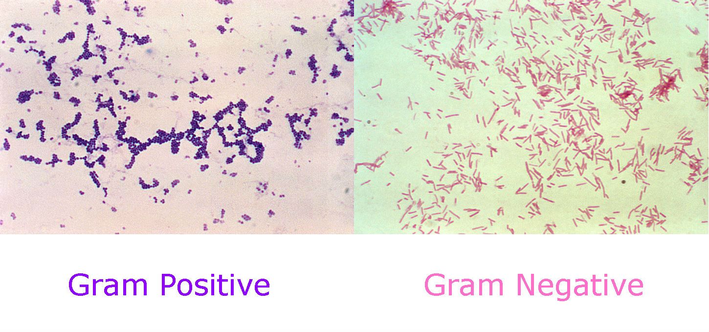 Gram Positive vs Gram Negative Gram Stain SimpleMed