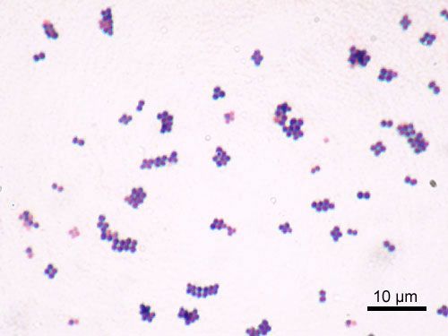 Staphylococcus Gram Stain - Diplococci SimpleMed