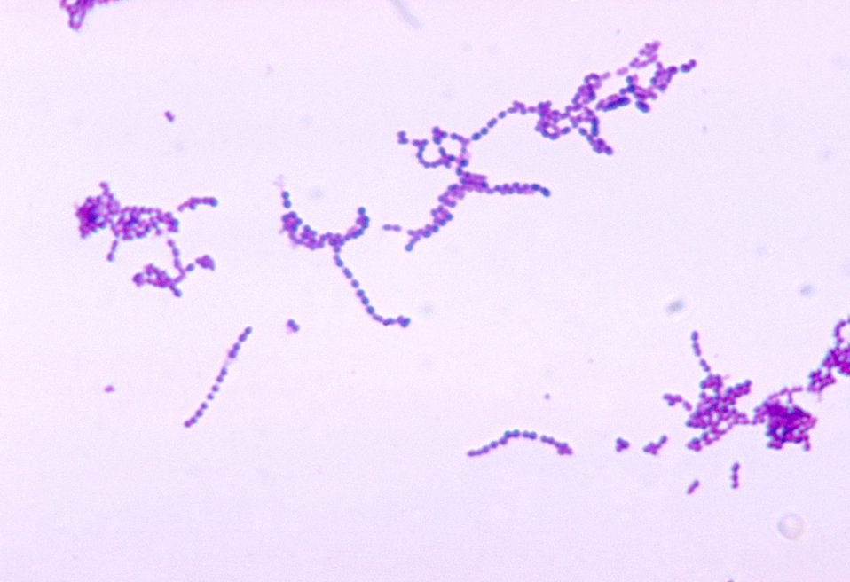 Streptococcus Gram Stain - Streps are Strips SimpleMed