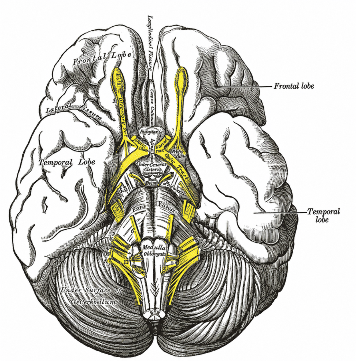Inferior surface of the brain with cranial nerves highlighted
