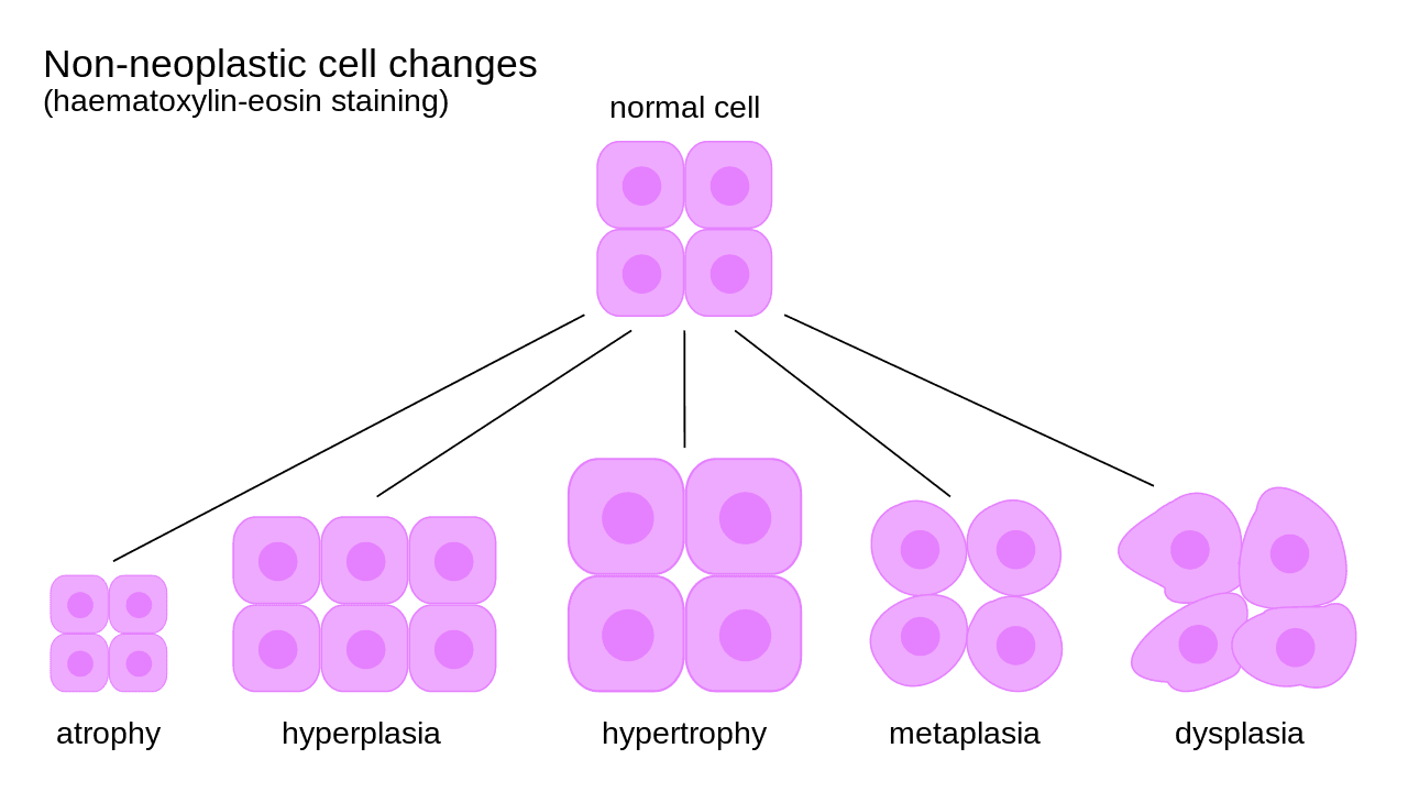 Non-Neoplastic Cell Changes SimpleMed