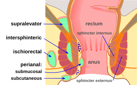 Locations of Perianal Abscesses SimpleMed
