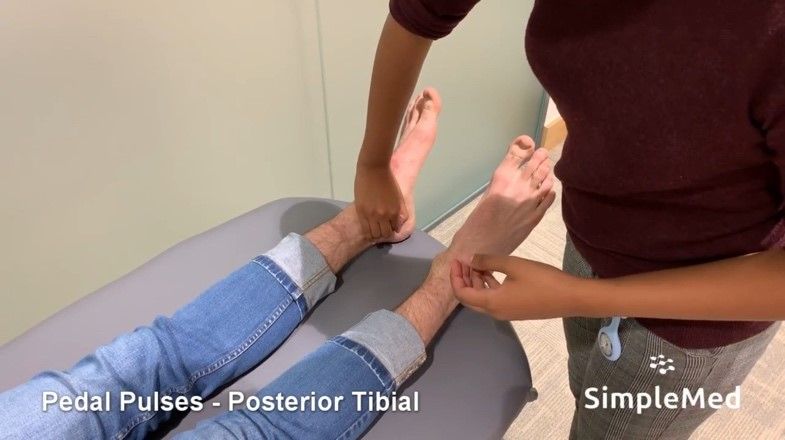 Posterior Tibial Pulse SimpleMed