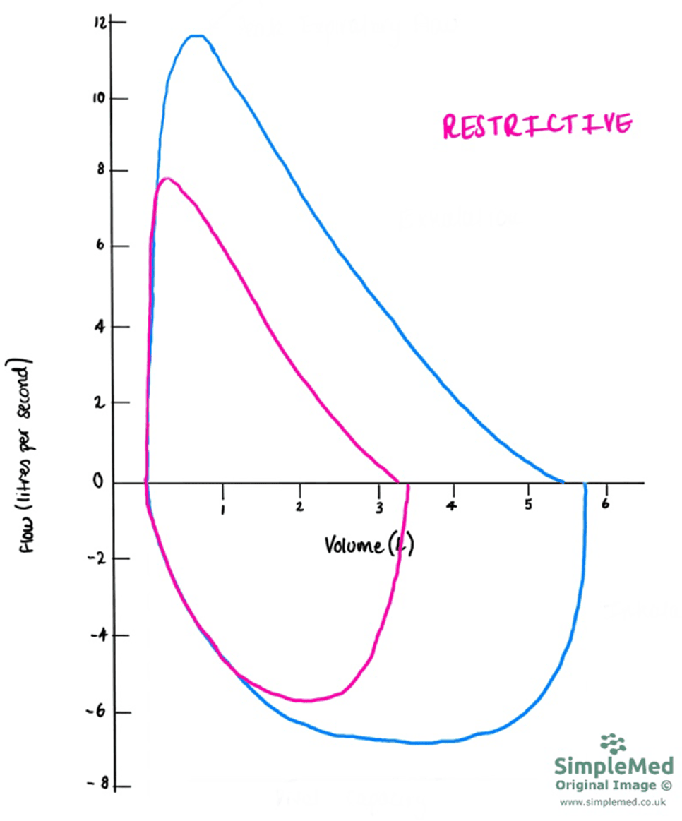 obstructive-vs-restrictive-lung-disease-usmle-youtube