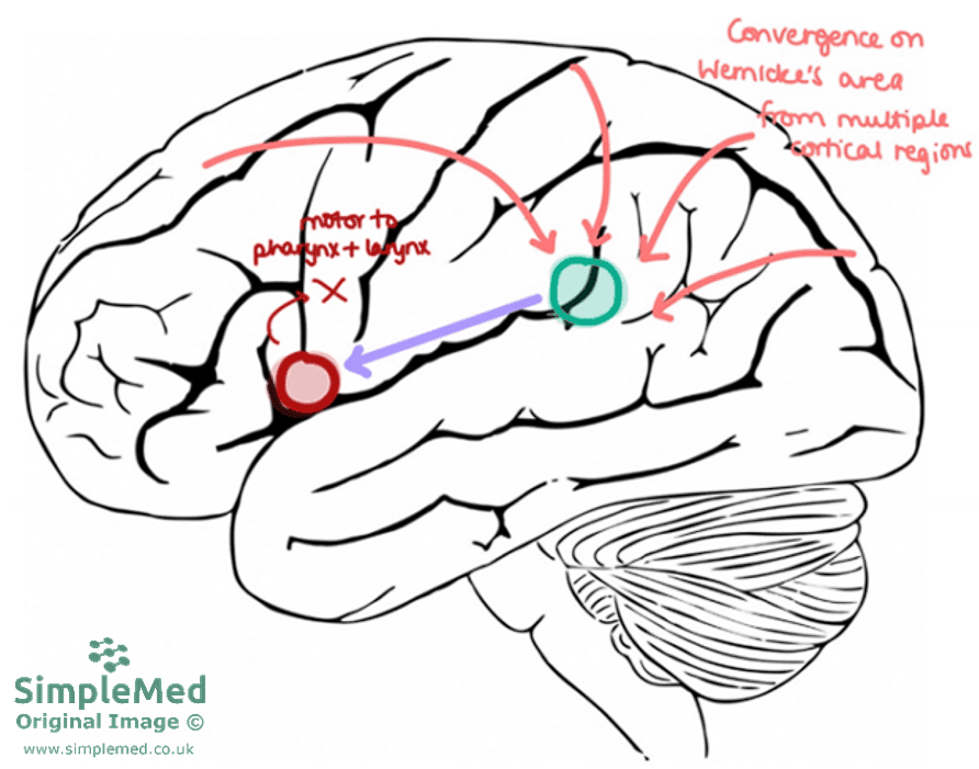 Pathway for Speaking a Though Word SimpleMed