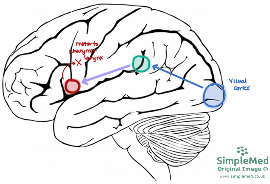 Pathway for Speaking a Written Word SimpleMed