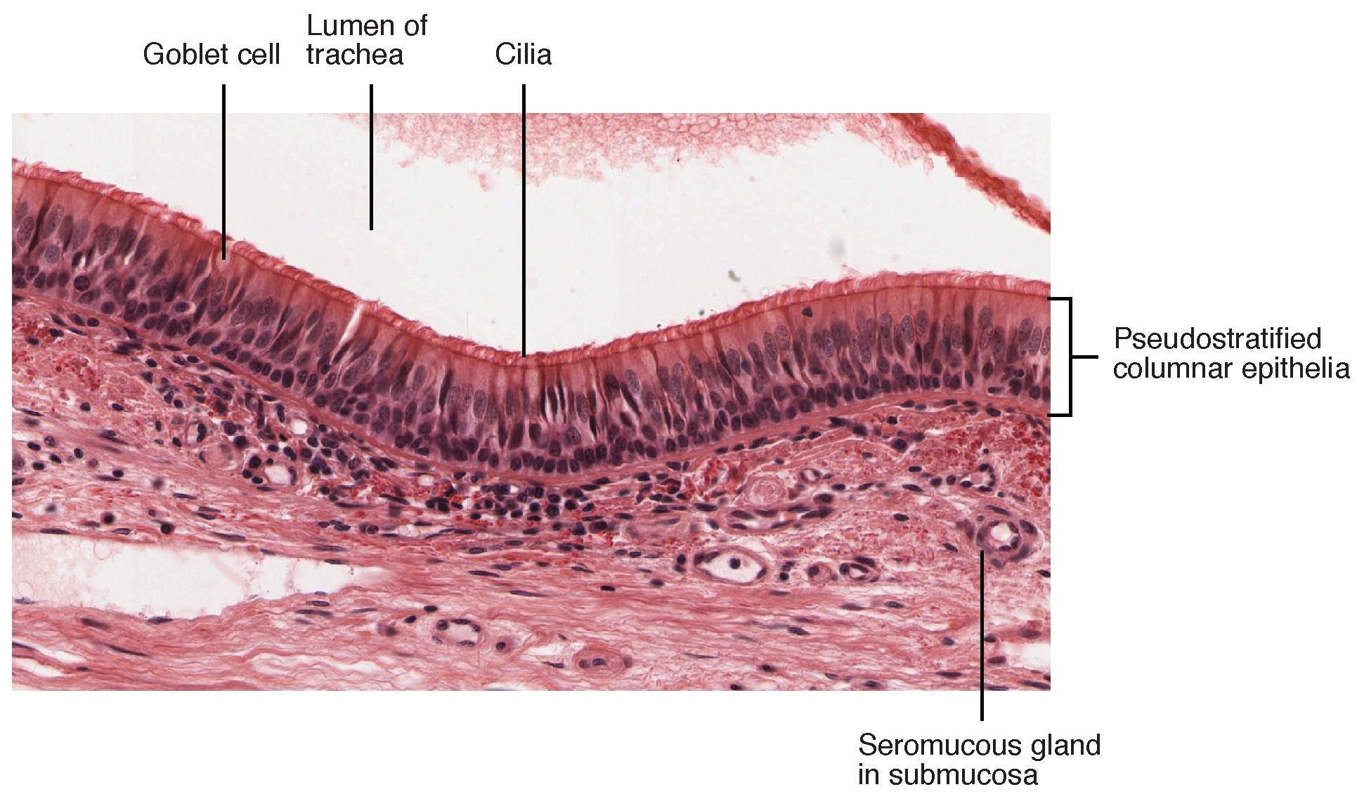 Histological Section of the Trachea SimpleMed
