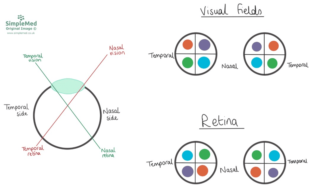 Visual Fields SimpleMed