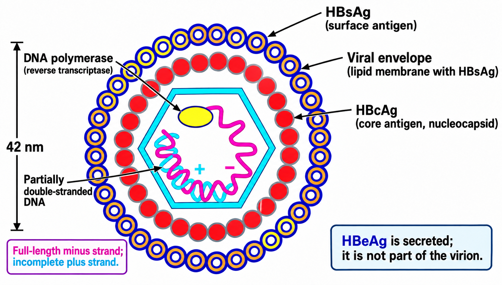 Hepatitis B virion with full-length minus DNA, incomplete plus DNA and secreted HBeAg outside the particle