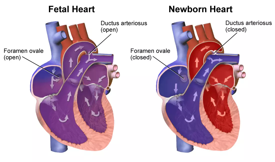 Changes in Heart After Birth SimpleMed