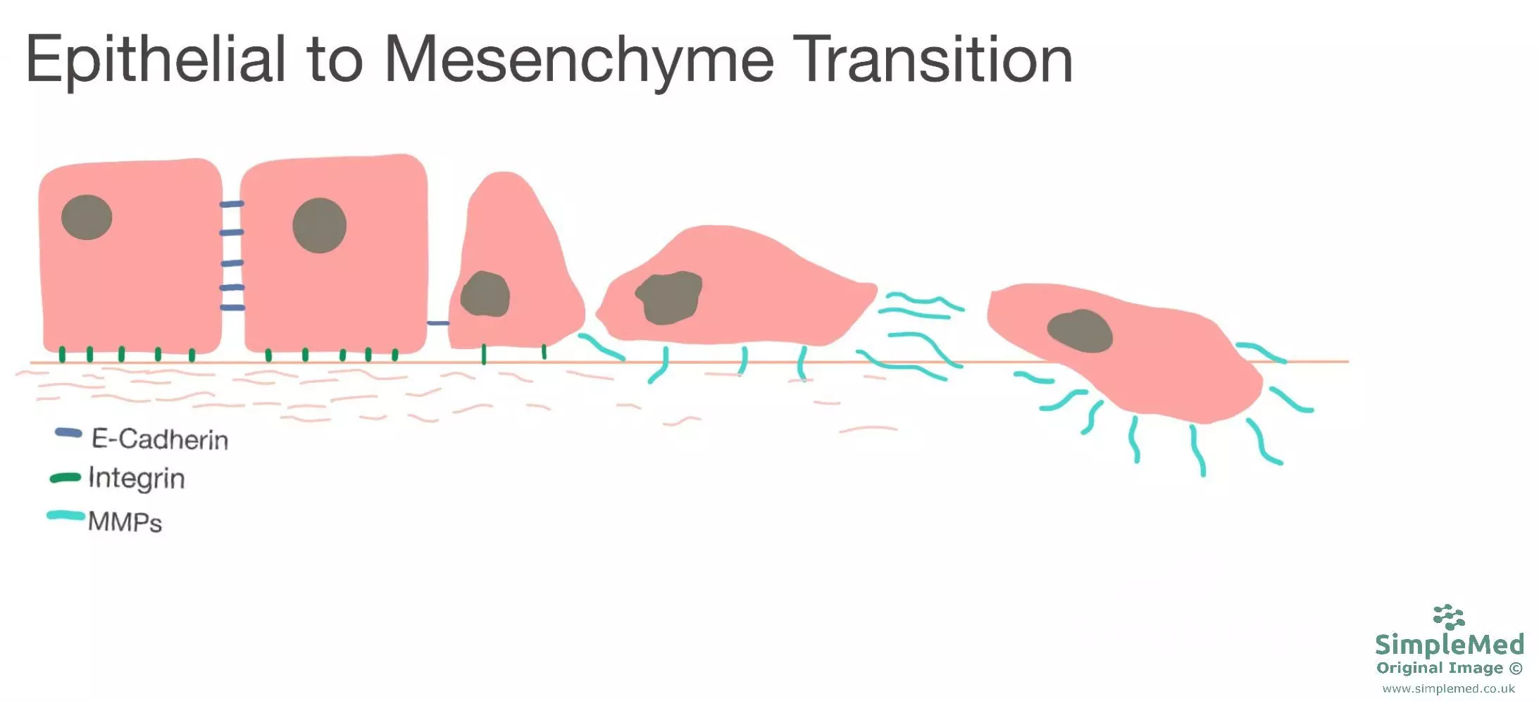 Epithelial to Mesenchyme Transition SimpleMed