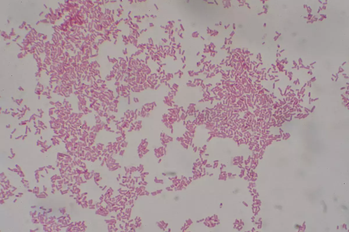 Escherichia Coli Gram Stain SimpleMed