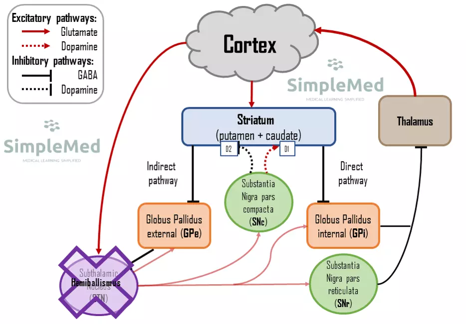 Motor Pathway in Hemiballismus SimpleMed