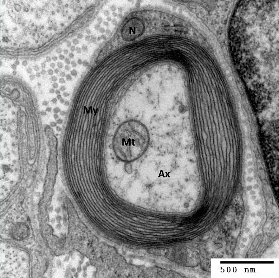 Electron Micrograph of a Myelin Sheath SimpleMed