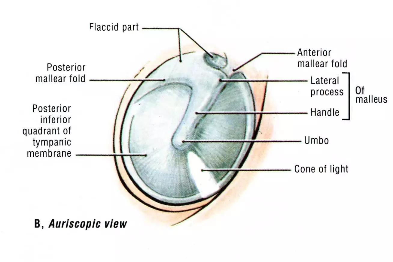 Otoscope of the Tympanic Membrane SimpleMed