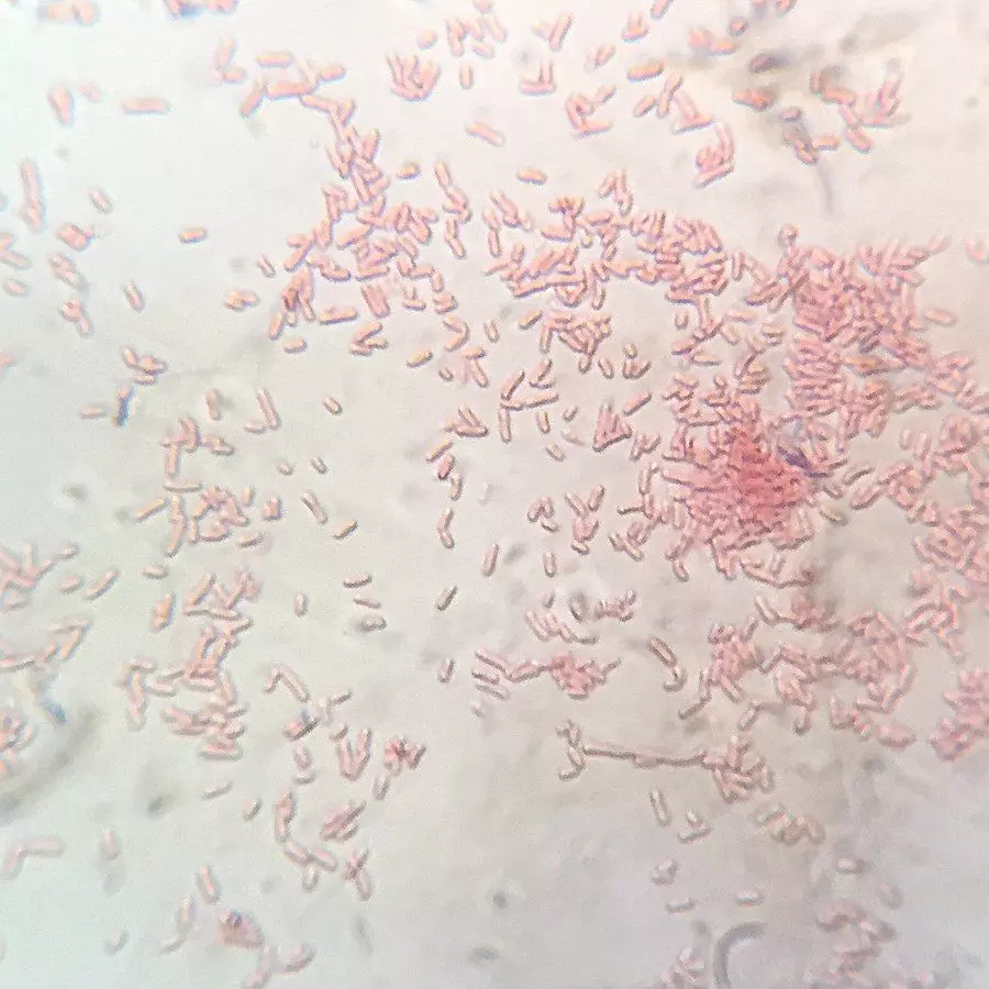 Shigella Flexneri Gram Stain SimpleMed