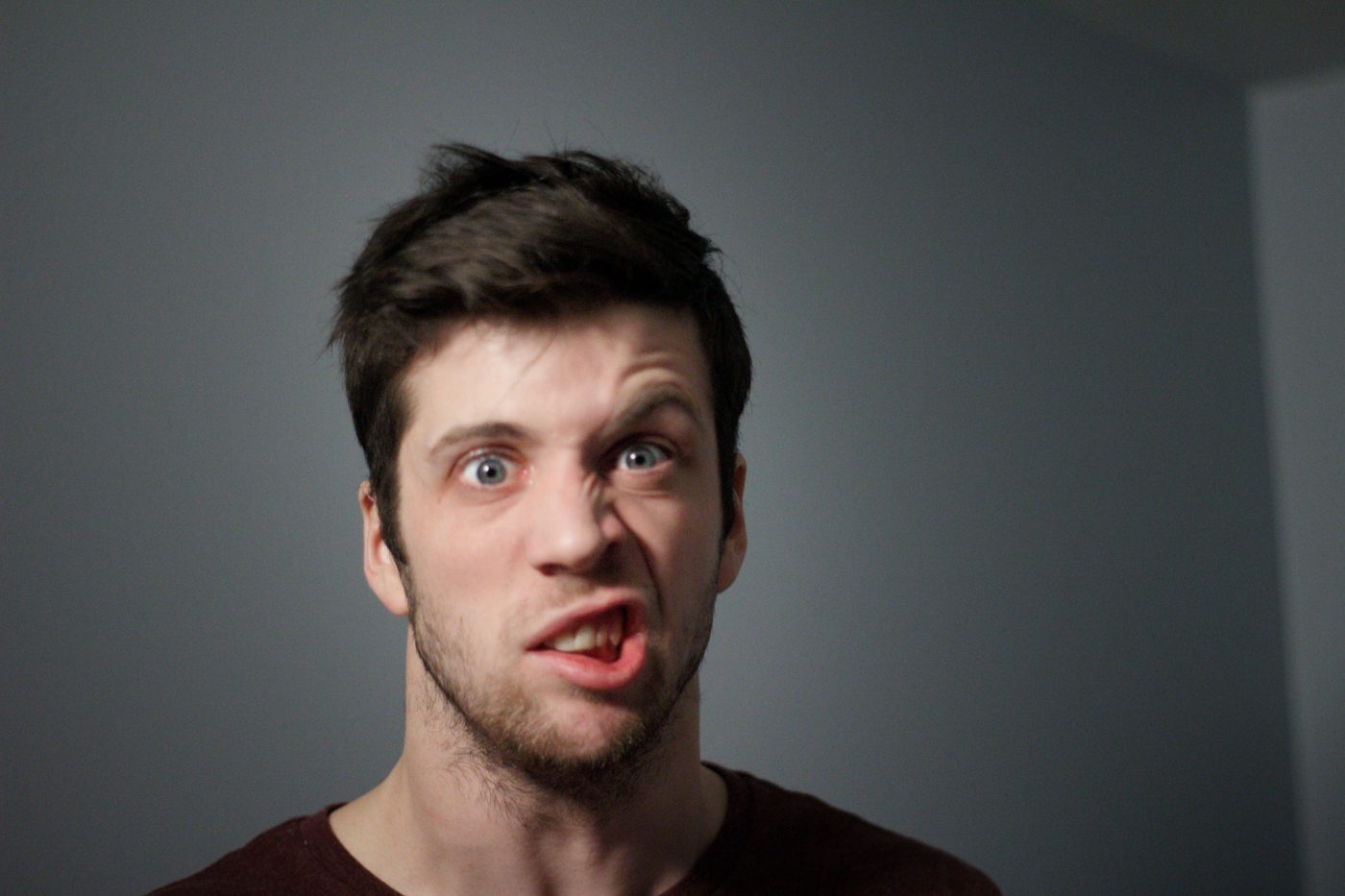 Facial Nerve Palsy Showing Teeth SimpleMed