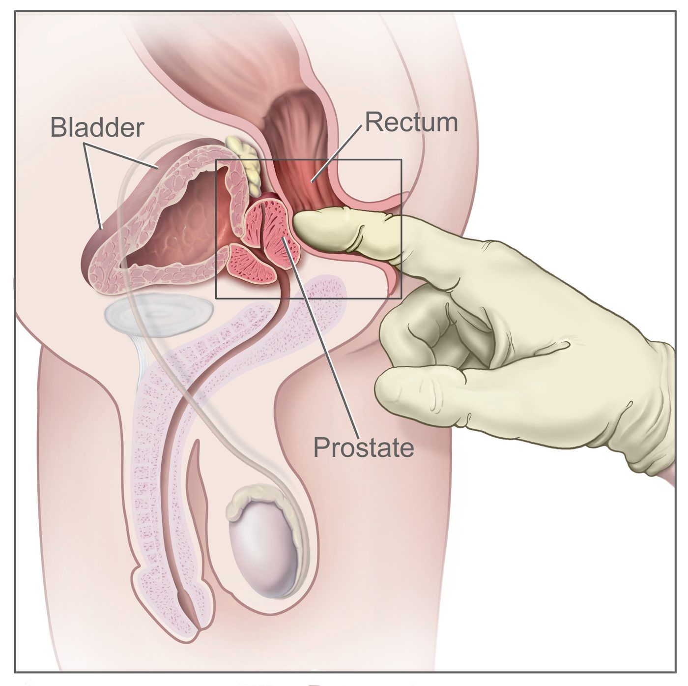 Digital Rectal Examination SimpleMed