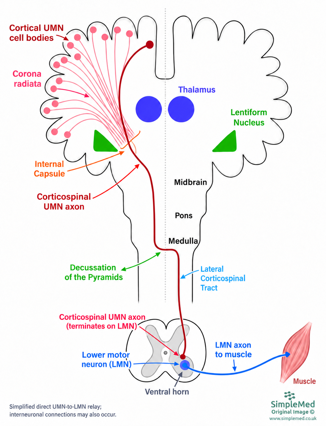 Cortical upper motor neurone axon descends through corona radiata, internal capsule, midbrain, pons and medulla, crosses at the pyramids and relays to a separate lower motor neurone in the right ventral grey horn; the lower motor neurone axon reaches muscle.